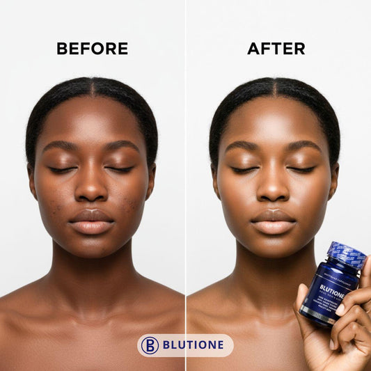 BLUTIONE L-glutathion complément alimentaire 2